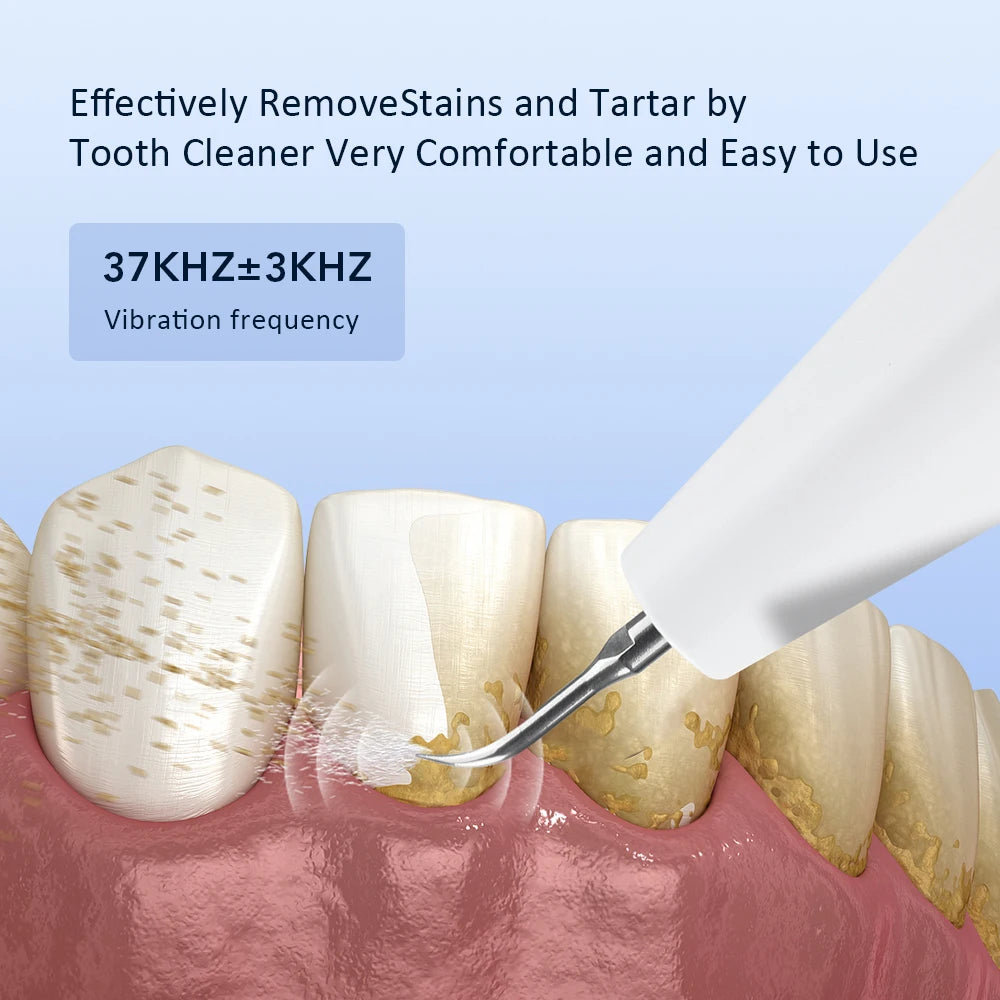 Ms.Dear Ultrasonic Dental Scaler — Teeth Tartar & Plaque Remover, LED, 3-Speed