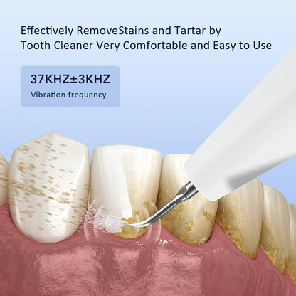 Ms.Dear Ultrasonic Dental Scaler — Teeth Tartar & Plaque Remover, LED, 3-Speed