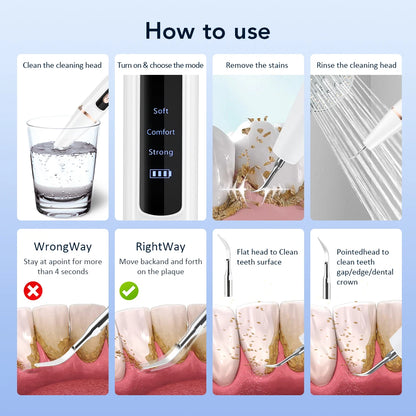Ms.Dear Ultrasonic Dental Scaler — Teeth Tartar & Plaque Remover, LED, 3-Speed