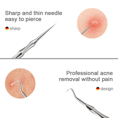 Stainless Steel Acne & Blackhead Extractor Tool – Pimple, Whitehead & Blackhead Remover | Hygienic & Portable | A / B / C / Full Set