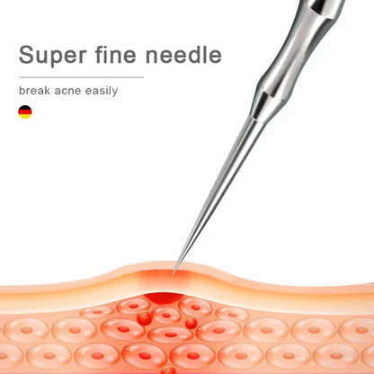 Stainless Steel Acne & Blackhead Extractor Tool – Pimple, Whitehead & Blackhead Remover | Hygienic & Portable | A / B / C / Full Set